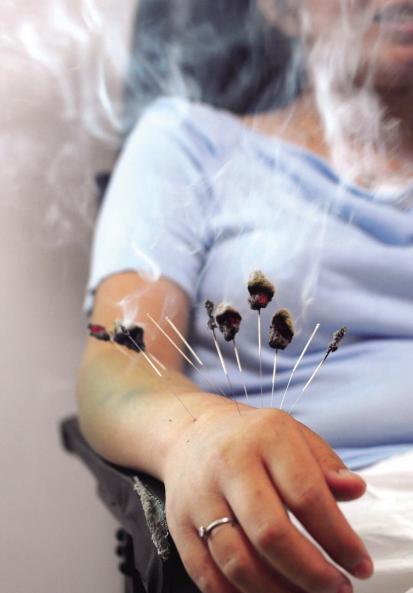 Warm-Needle Moxibustion